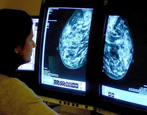Beta Blockers May Slow Spread of Aggressive Triple-Negative Breast Cancer, Study Suggests
