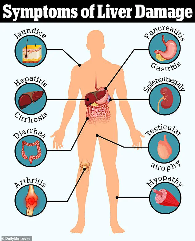 Diagnosis of Primary Sclerosing Cholangitis in a Teenager with Crohn's Disease