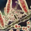 GP Issues Stark Warning: Athlete's Foot, Often Overlooked, Can Be Contagious and Life-Threatening