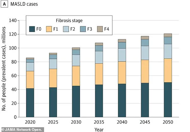 Groundbreaking Study Reveals Silent Link Between Liver Condition and Leading Cause of Death in the US