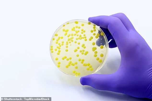 UKHSA Urges Hygiene Precautions as Community MRSA Cases Surge 47% in UK, Under-4s at Risk