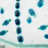 Valley Fever: Environmental Factors and Health Impacts of Coccidioides immitis