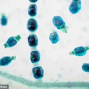 Valley Fever: Environmental Factors and Health Impacts of Coccidioides immitis