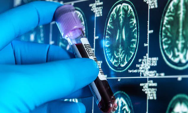 Landmark Trial Aims to Revolutionize Alzheimer's Diagnosis with Non-Invasive Blood Test for Early Detection