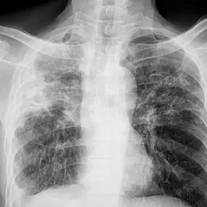 Public Health Teams Mobilized in Maine as TB Cases Spark Health Advisories
